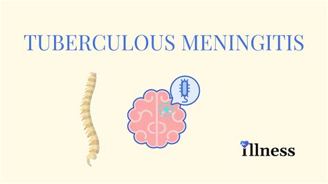 meningite tuberculosa